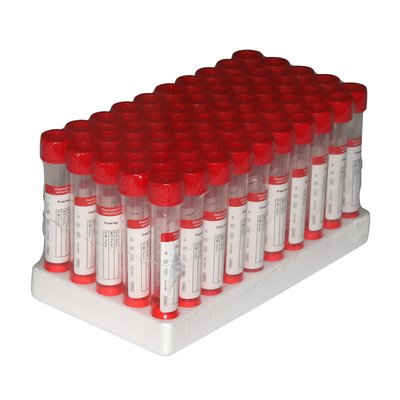 Nasaler Mundnylonputzlappen-Stock VTM Kit Sterilization Packaging