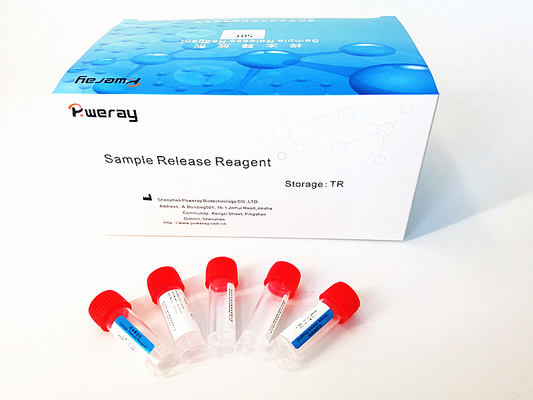 Nasale Exemplar PCR-Entdeckung Viren-RNS Mini Kit With ISO 13485